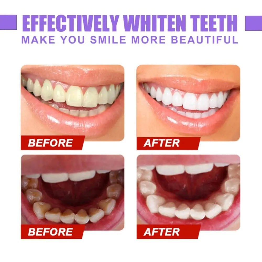Eelhoe Enamel Care