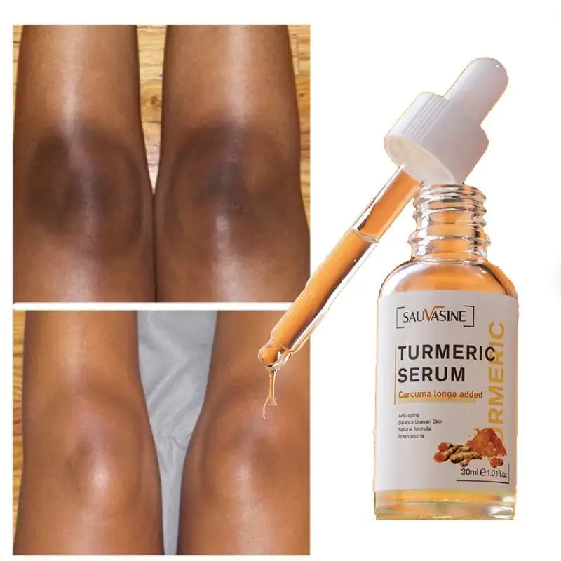 Sauvasine Natural Glow Serum: Turmeric Infused Skincare Solution